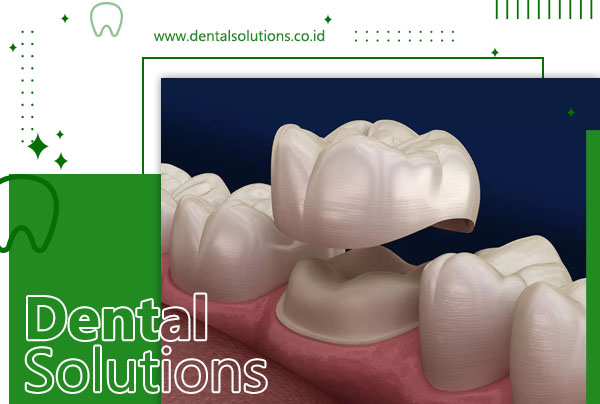 Dental Solutions – Klinik Gigi Dental Solutions | Praktek Dokter Gigi ...